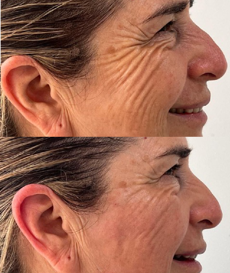 clinica de estetica dental en bogota