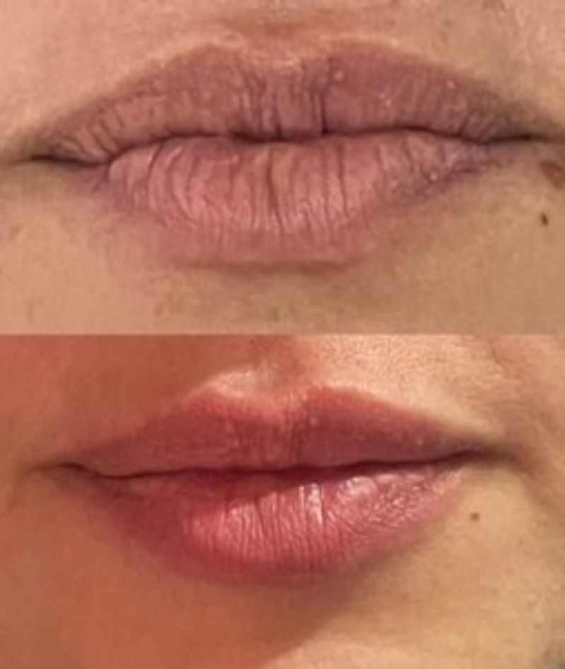 clinica de estetica en cota