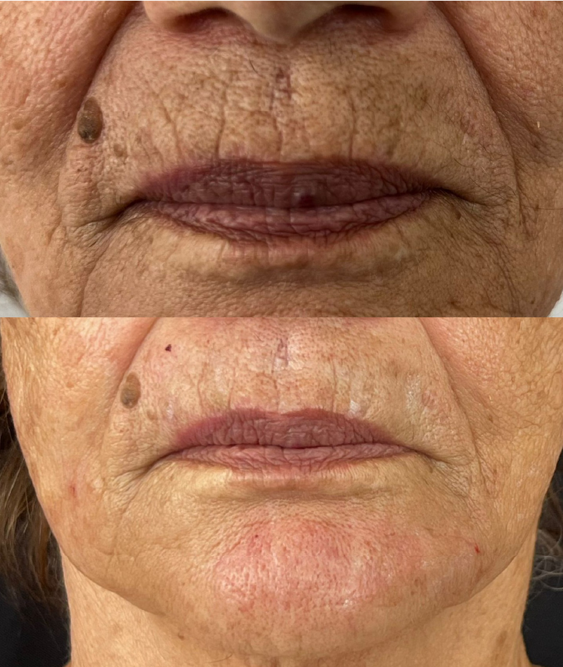 clinicas de estetica en chia