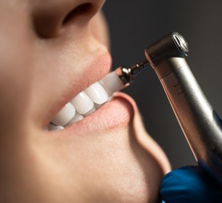 limpieza dental bogota